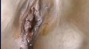 வன்னா பார்டோட்